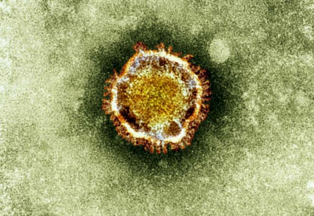 Πρώτο κρούσμα ιού της οικογένειας SARS στη Γαλλία